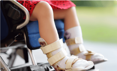 child sitting in wheel chair with leg braces